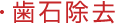 歯石除去